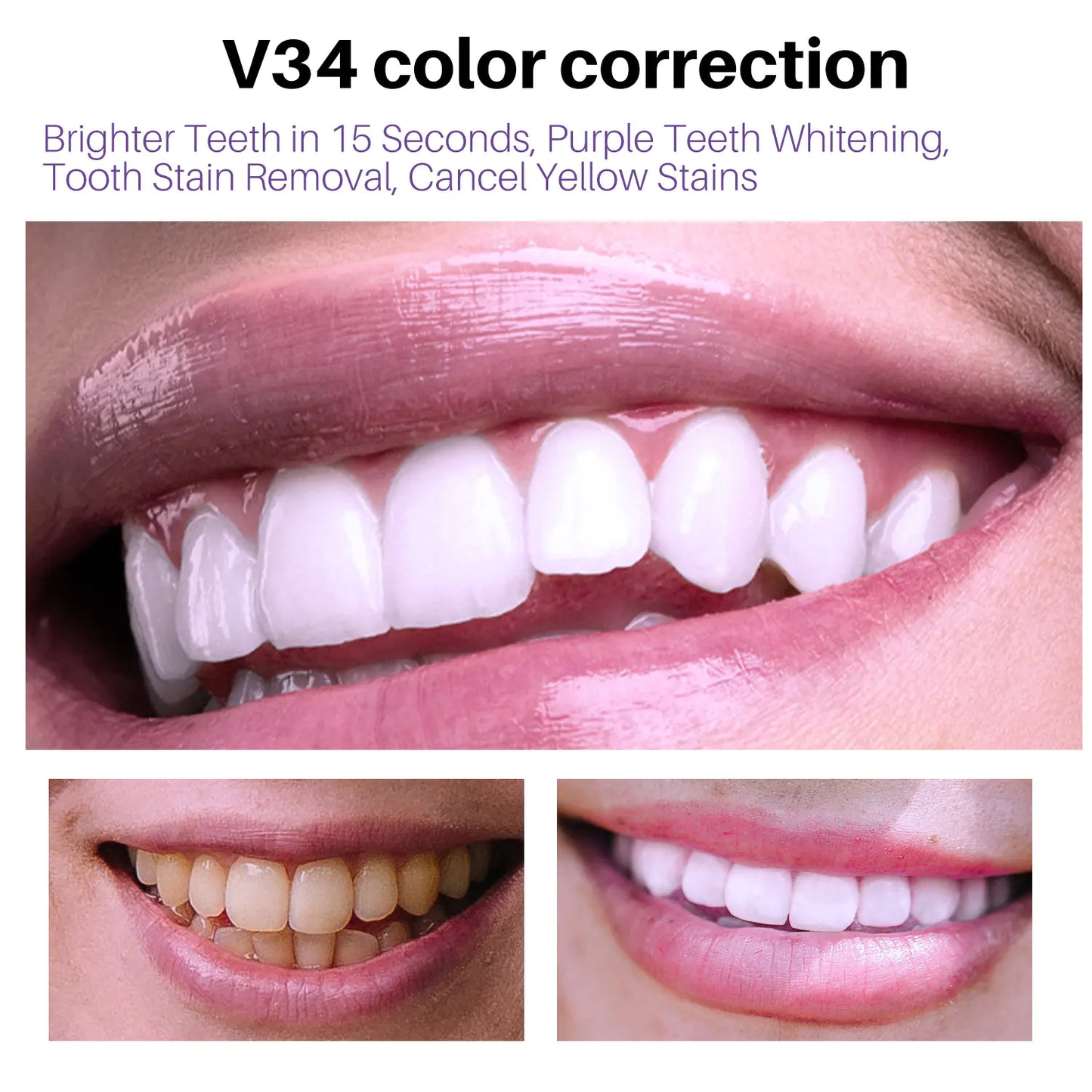 Lanthome V34 Teeth Whitening Mousse for Oral Care