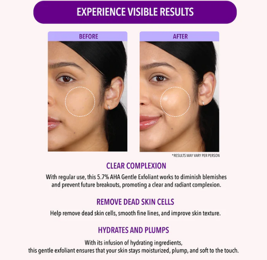 5.7 AHA GENTEL EXFOLIANT