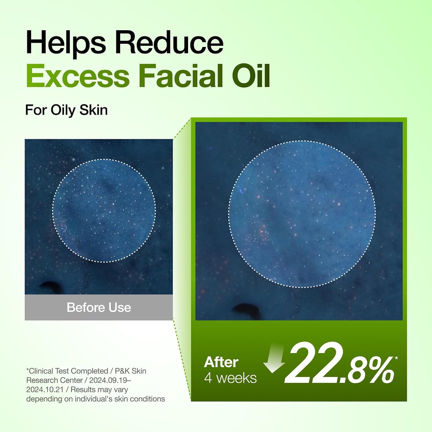 Azelaic Acid 10 Hyaluron Redness Soothing Serum, Facial Serum for Blemish-Prone & Oily-Prone Skin, Lightweight & Hydrating Blemish Care, Hyaluronic Acid, Korean Skincare, 1.01 Fl Oz.