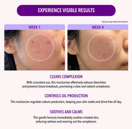 10% NIACIMADICE OIL CONTROL MOISTURIZER