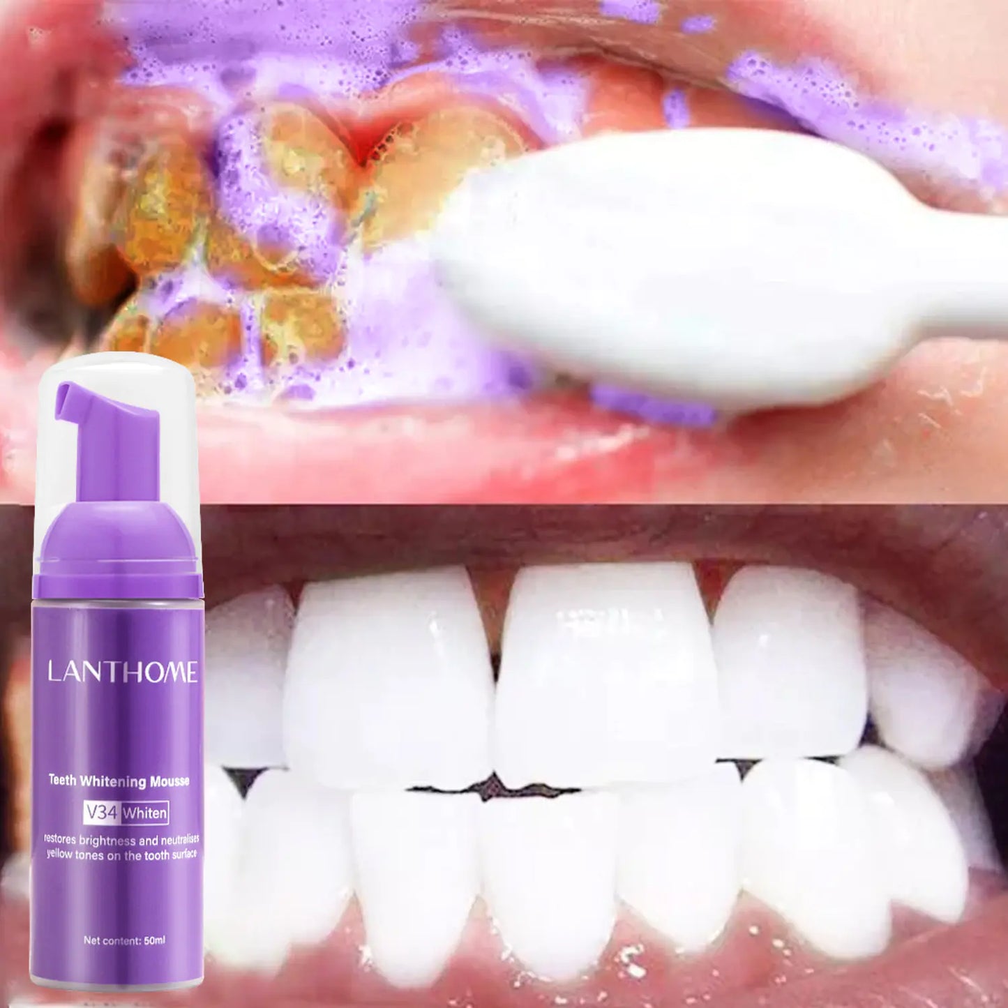 Lanthome V34 Teeth Whitening Mousse for Oral Care