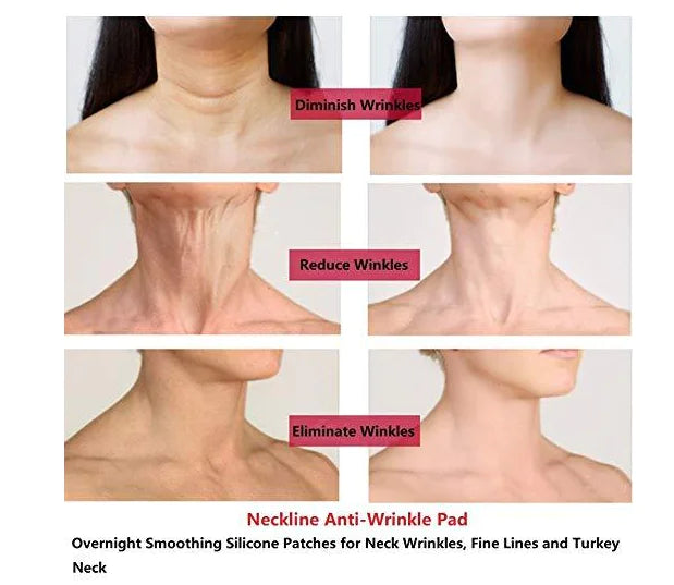 Silicone Neck Patch for Wrinkle Prevention