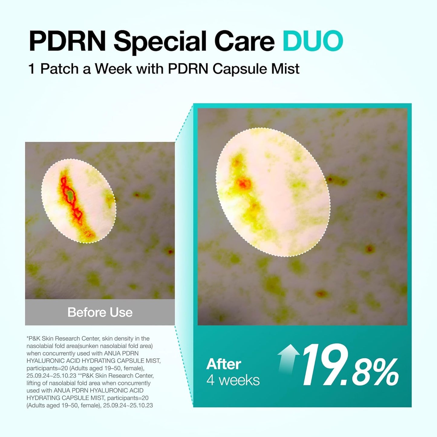 Salmon DNA PDRN Collagen Melting Patch for Glass Skin, Smile Line Patches, Wrinkle Patches, Melting Thin Collagen Patch, Firming for Fine Lines, Glow, Korean Skincare, 2 Pairs X 4EA, Patch Only