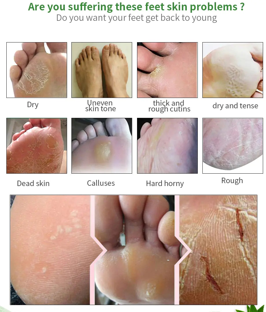 Moisturizing Foot Mask for Exfoliation and Care